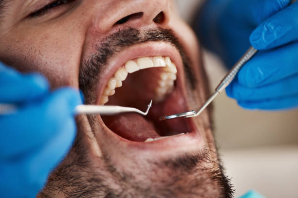 Best Cracked Tooth Emergency Dentist  in Mount Healthy Heights, OH